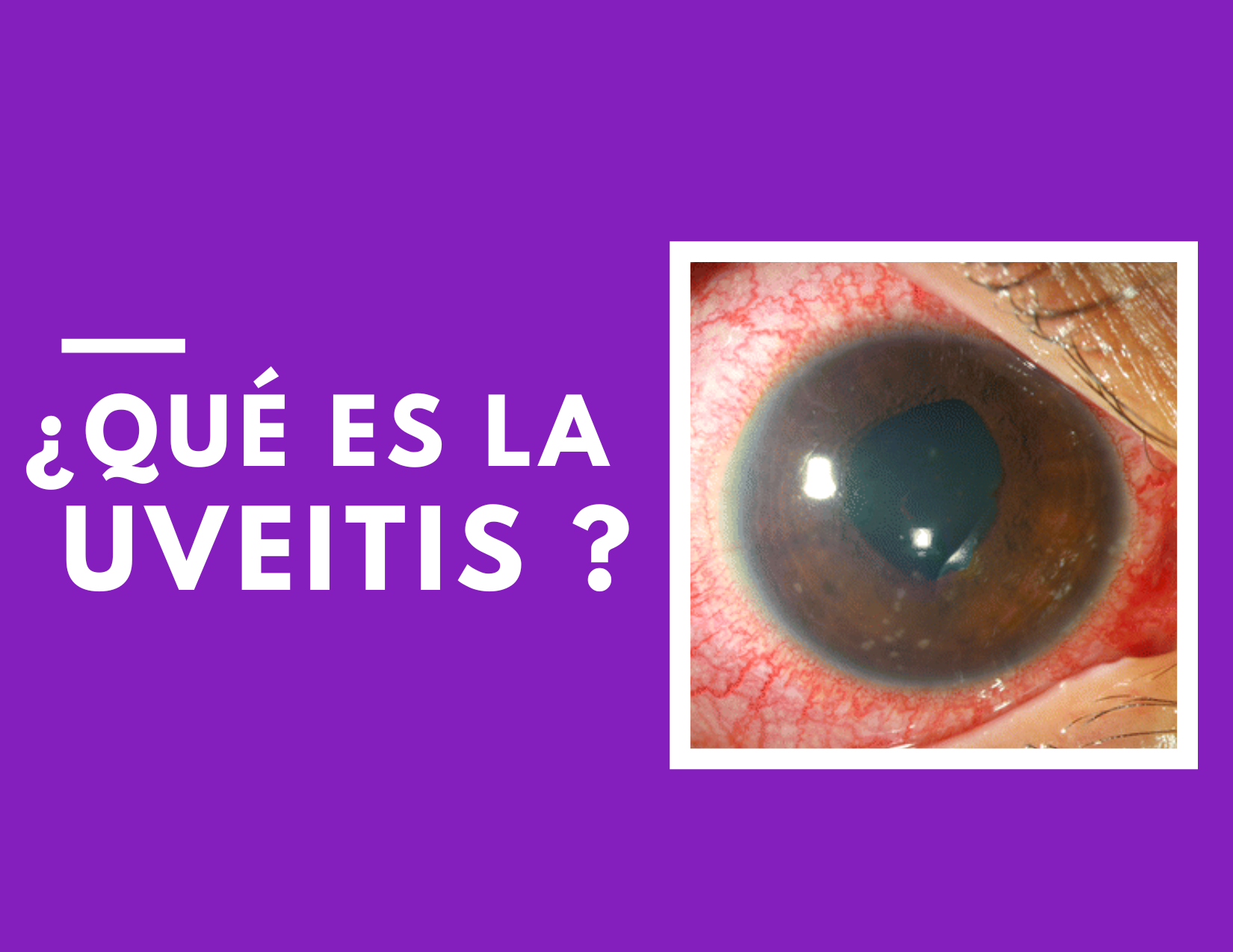 uveitis guayaquil