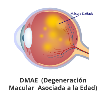DMAE Retinólogo en guayaquil